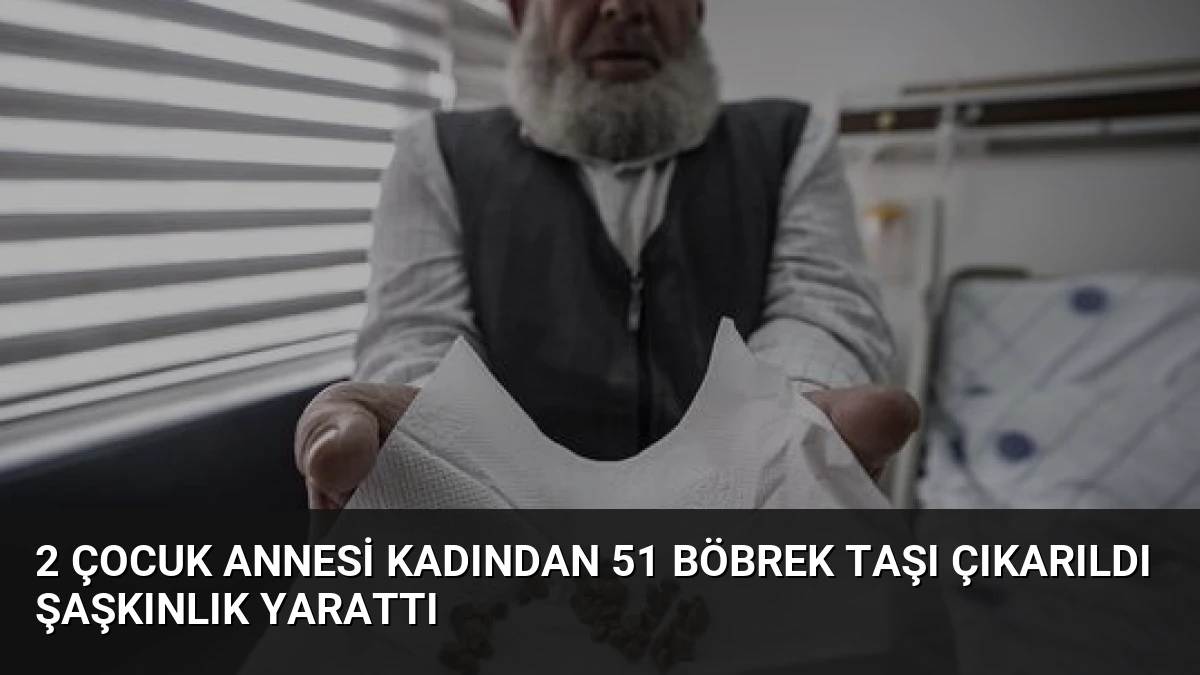 2 Çocuk Annesi Kadından 51 Böbrek Taşı Çıkarıldı Şaşkınlık Yarattı