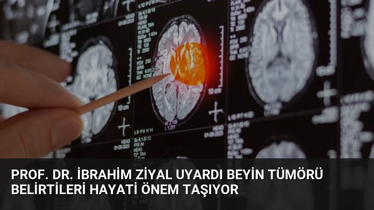 Prof. Dr. İbrahim Ziyal Uyardı Beyin Tümörü Belirtileri Hayati Önem Taşıyor
