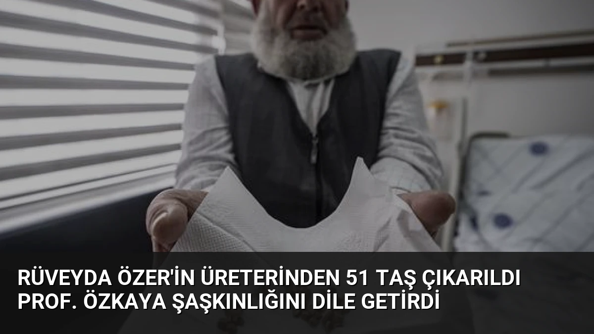 Rüveyda Özer’in Üreterinden 51 Taş Çıkarıldı Prof. Özkaya Şaşkınlığını Dile Getirdi