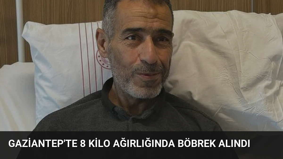 Gaziantep’te 8 Kilo Ağırlığında Böbrek Alındı