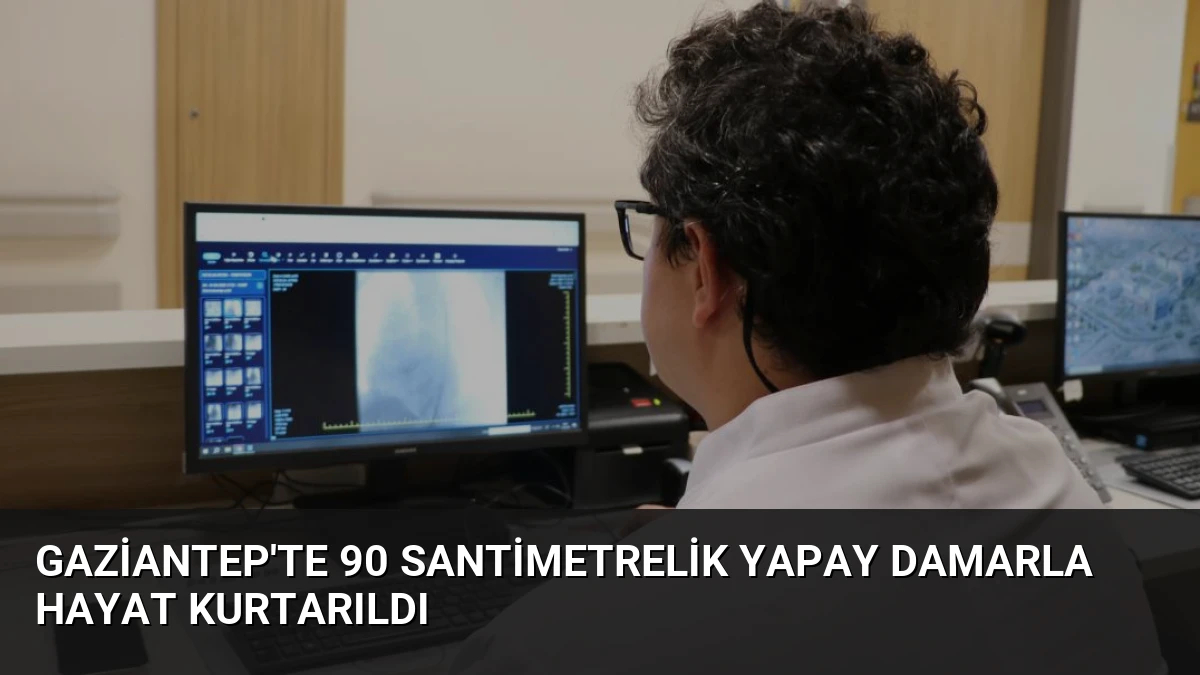 Gaziantep’te 90 Santimetrelik Yapay Damarla Hayat Kurtarıldı