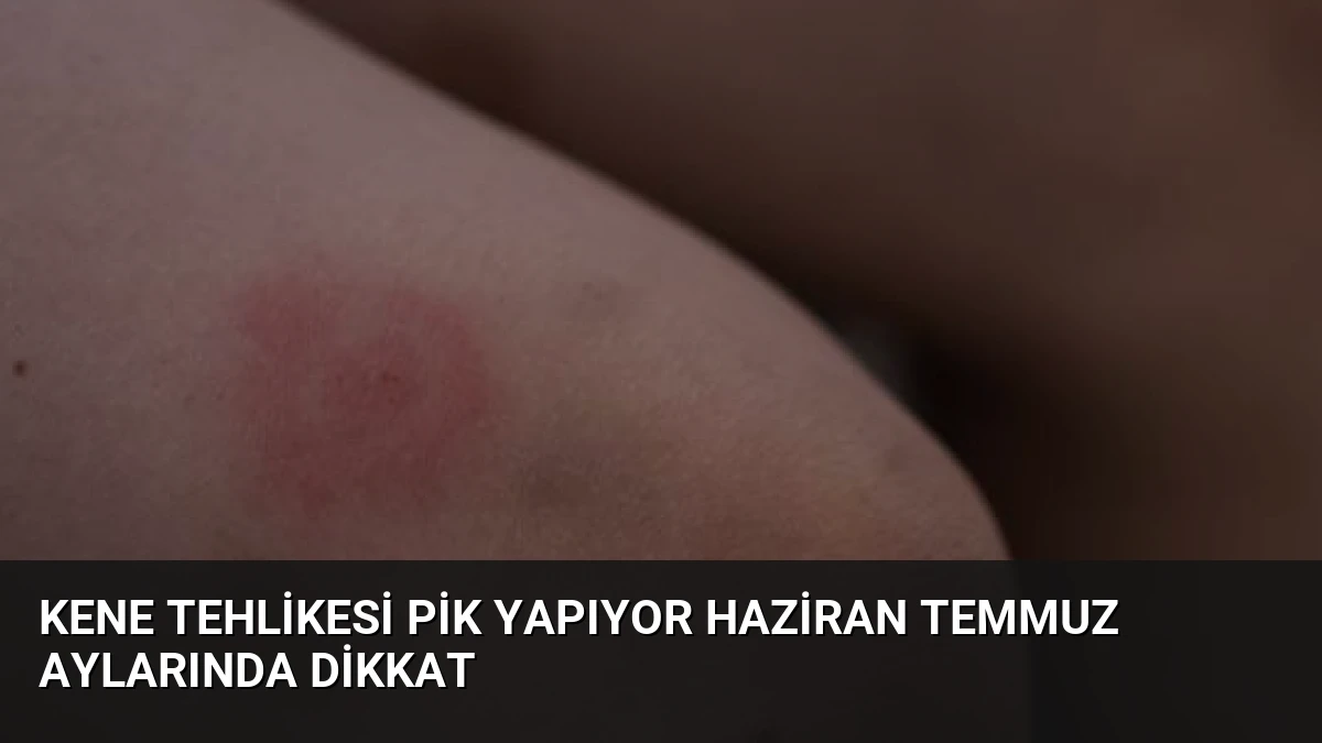 Kene Tehlikesi Pik Yapıyor Haziran Temmuz Aylarında Dikkat
