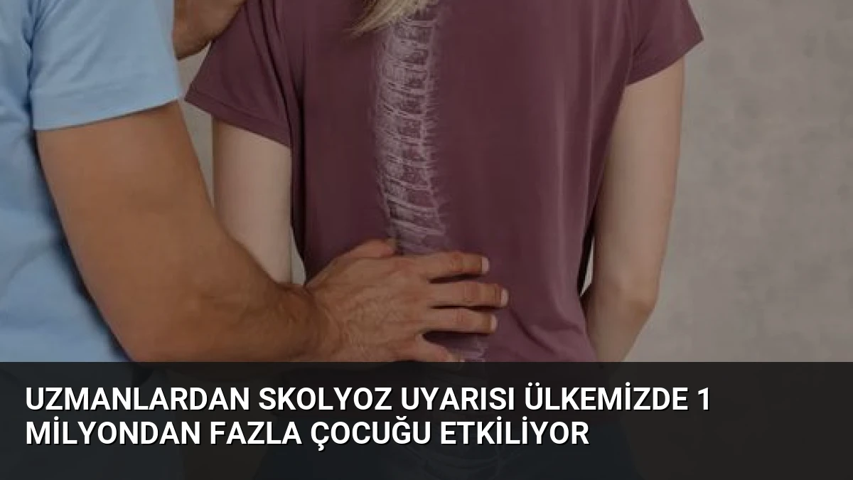 Uzmanlardan Skolyoz Uyarısı Ülkemizde 1 Milyondan Fazla Çocuğu Etkiliyor