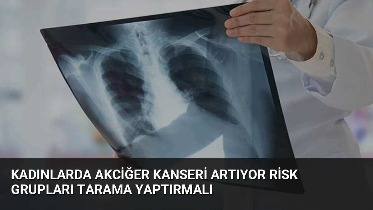 Kadınlarda Akciğer Kanseri Artıyor Risk Grupları Tarama Yaptırmalı